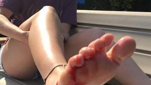 Another Reported Musky Attack in Minnesota