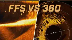 Tech Battle: When to Use FFS or 360 Imaging